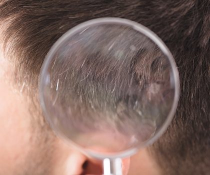 Jeffrey Paul’s Hair & Scalp Specialists can help you correct, prevent or restore hereditary hair loss