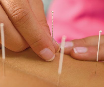 The power of acupuncture