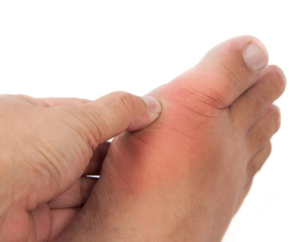 Natural support for gout