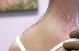 Needles