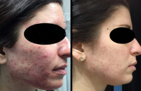 Lucy Before After